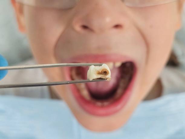 Best Emergency Dental Care for Abscessed Tooth in Harlan, IN